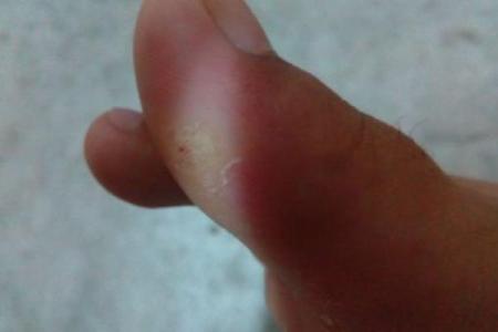 红色的脚趾代表的命运与象征——探索其深层意义与影响