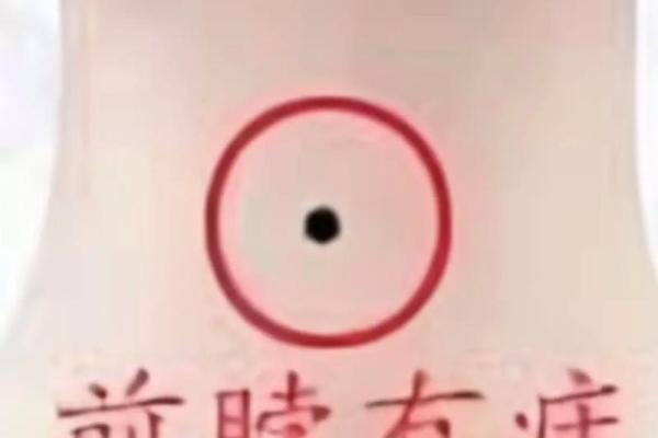 解读脖子后有痣的命理与性格特征，助你更好了解自己
