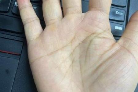 指甲横纹图案的秘密揭示：揭开心灵与命运的神秘之门