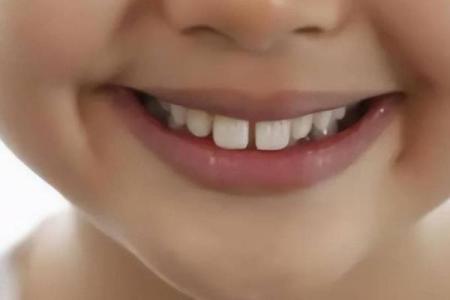 20颗牙齿的命运：从牙齿看人生的哲理与启示