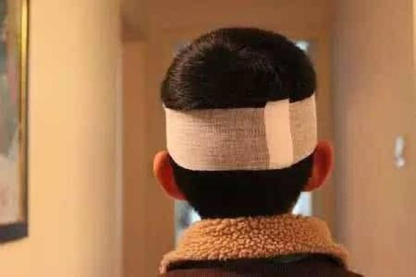 探秘头上长脓包的原因与健康提示，教你如何应对与预防