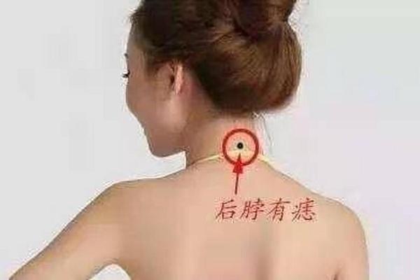 没有痣的女人命运解析：她们的独特人生与未来运势