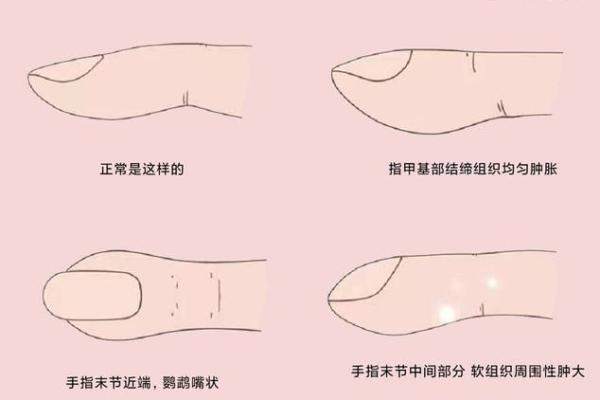 指甲形状揭示命运奥秘，探索你的指甲与性格命运的关系