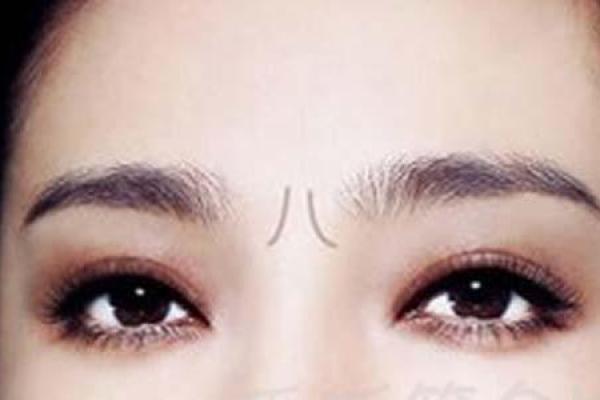 女人脖子有猴子纹的命运解读与生活启示 女人脖子有猴子纹的命运解读与生活启示