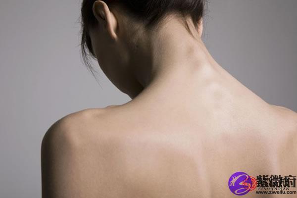 腰上胎记的秘密：你知道它们暗示着什么命运吗？