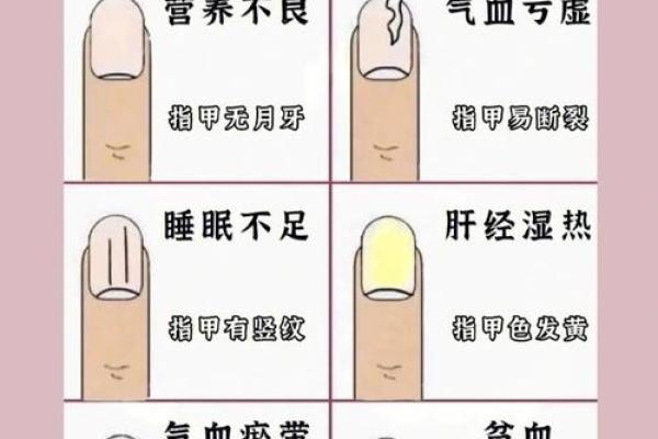 看指甲测命：揭秘你的命运与性格关系