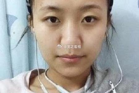 没有鼻梁的人命运揭秘：与众不同的人生体验