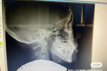 31棵牙齿的命运象征：牙齿健康与人生的微妙联系