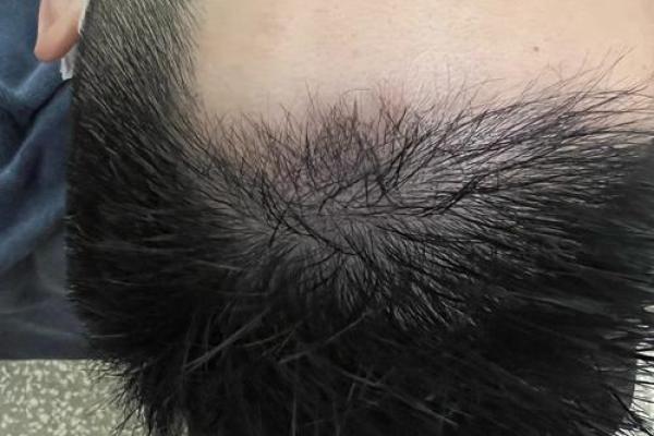 额头扁平的秘密：为何被认为是命好的人？