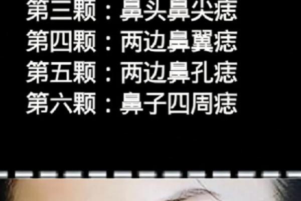 鼻子下面长瘊子意味着什么？解密生活中的命运暗示！