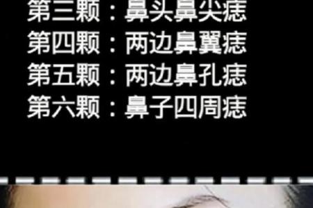 鼻子下面长瘊子意味着什么？解密生活中的命运暗示！