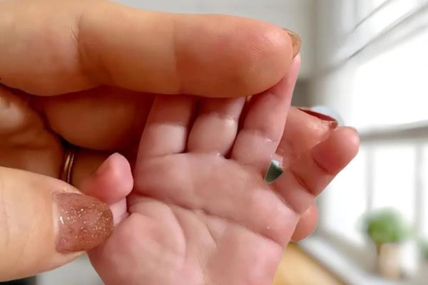 双手断掌揭秘：隐藏在手掌中的命运密码