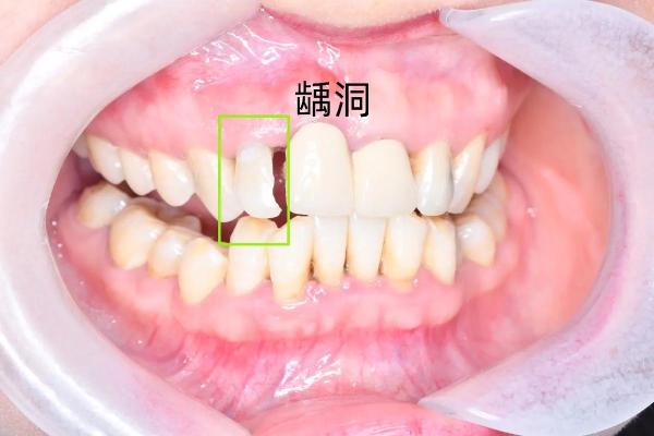 32颗牙齿的命运：口腔健康与人生命运的奇妙关系