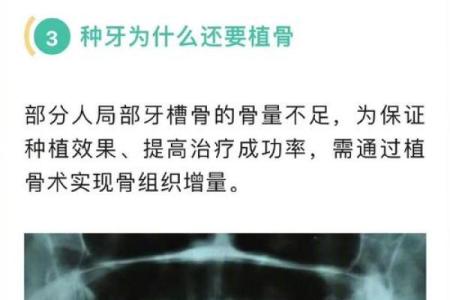 26颗牙齿背后的命运密码：揭示牙齿与命运的深刻联系
