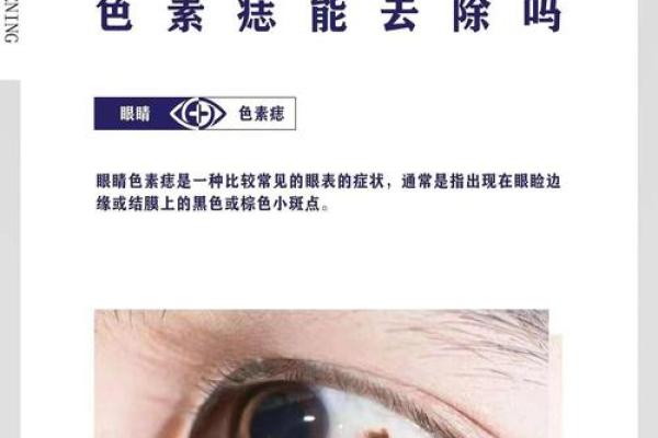 眼珠上的痣暗示着什么？揭开命运的神秘面纱！