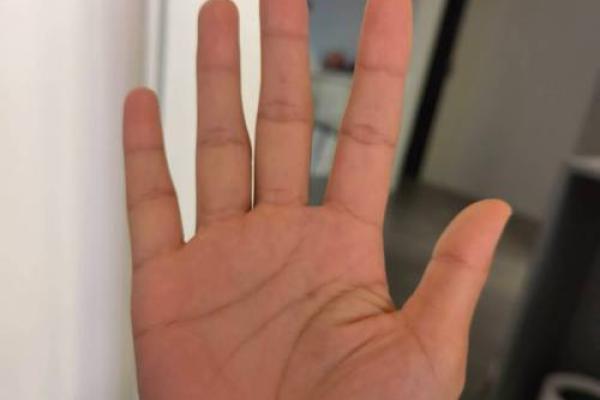 手掌指纹凸起揭示你的命运之路：指纹与个性、健康的奥秘探析