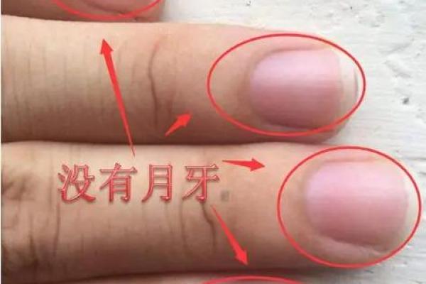 月牙指甲：揭秘指甲月牙背后的命运象征与健康秘密