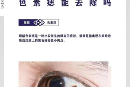 眼珠上的痣暗示着什么？揭开命运的神秘面纱！