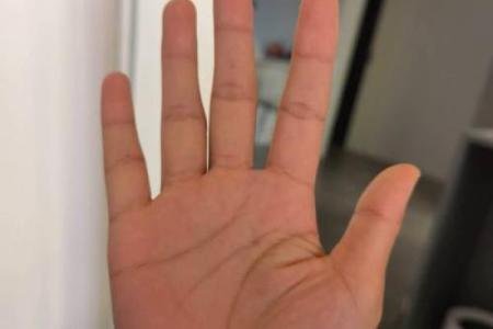 手掌指纹凸起揭示你的命运之路：指纹与个性、健康的奥秘探析