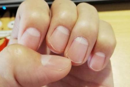 月牙指甲：揭秘指甲月牙背后的命运象征与健康秘密