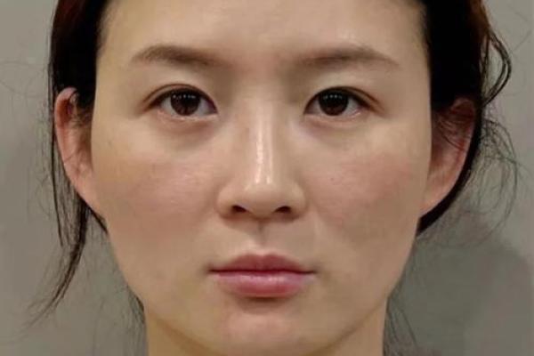 瘦脸大女人的命运：美丽与智慧的交织之路