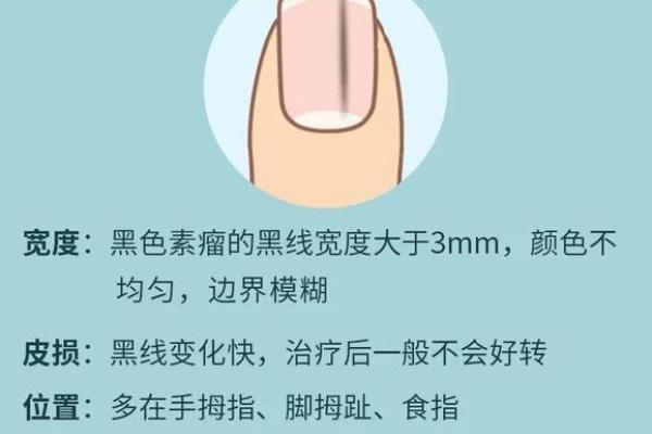 指甲短的命运解析：揭示手指背后的秘密与人生轨迹