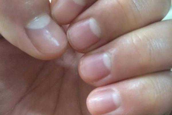 指甲短的命运解析：揭示手指背后的秘密与人生轨迹