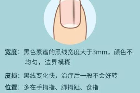 指甲短的命运解析：揭示手指背后的秘密与人生轨迹