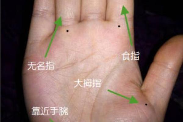 手腕对称痣的命运解读：揭示命理中的神秘之美