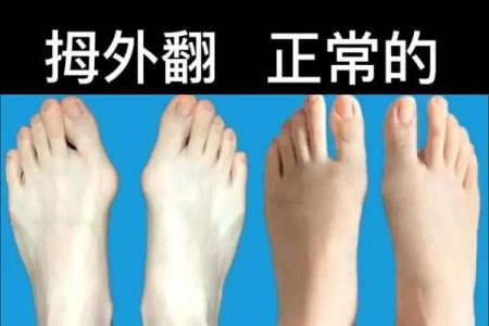 左脚大拇指短的命理解析：看看你和我有什么不同！