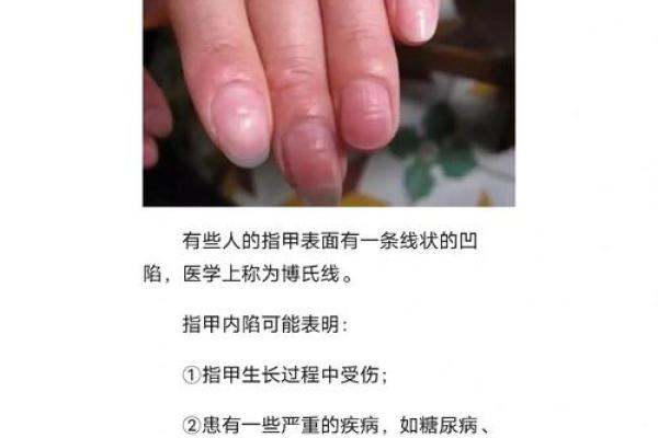 女生指甲的形状与命运：大厚指甲的秘密解析