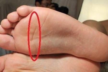 右脚比左脚大，如何解析这一现象的命理玄机？