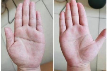 手纹杂乱背后的命运密码：探究人生的独特轨迹