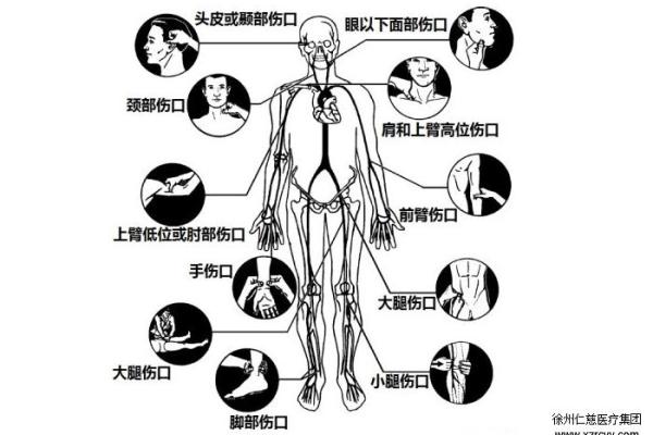 猎人与命运的博弈：一命换一命的背后