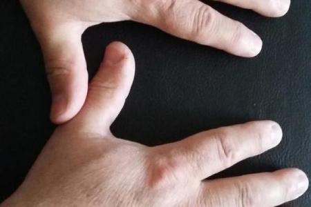 揭示手背青筋凸起的秘密：它暗示了你的命运与性格特征！