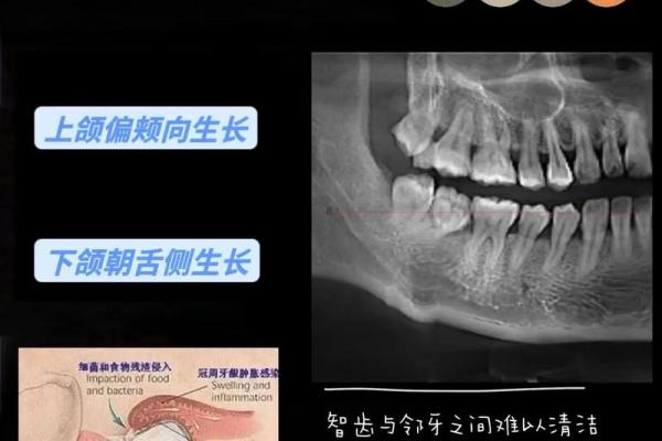 智齿与命运：探秘女人的口腔与人生轨迹