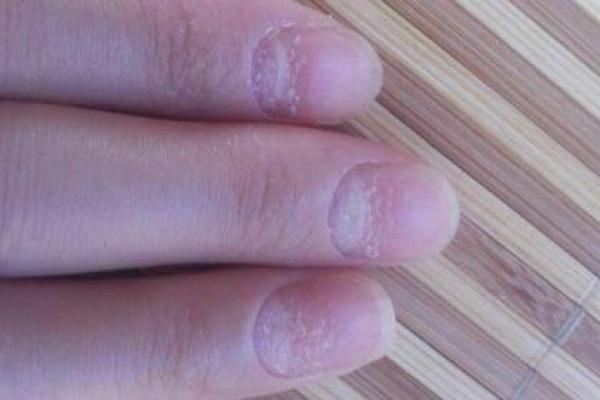 指甲横纹图案解析：揭示你命运的密码