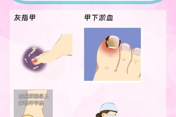 指甲弯的秘密：它预示着你的命运与个性！