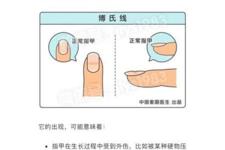 指甲弯的秘密：它预示着你的命运与个性！