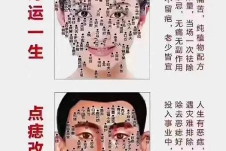 满脸痣的人在命理中象征着什么？解读痣相与命运的关系