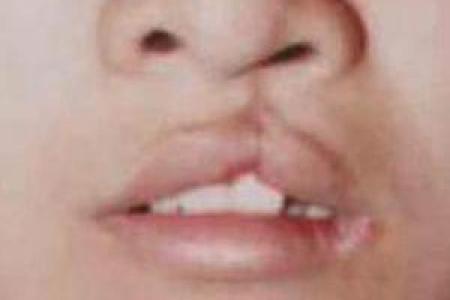 嘴唇厚外翻的人生特点与命理解析，揭示嘴唇的秘密！