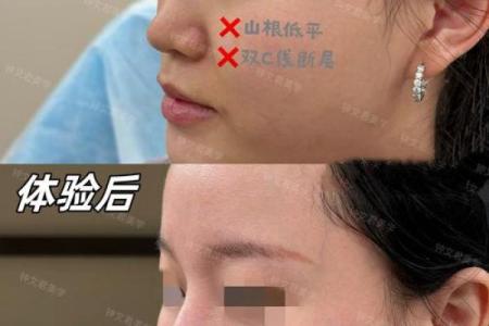 女生鼻子塌的命运分析：神秘面相与性格关系探讨