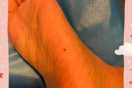 脚底有痣无命无命：解读生命中的那些神秘信号