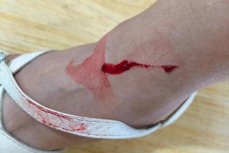 老是腿受伤的人，命运之路如何走出困境？