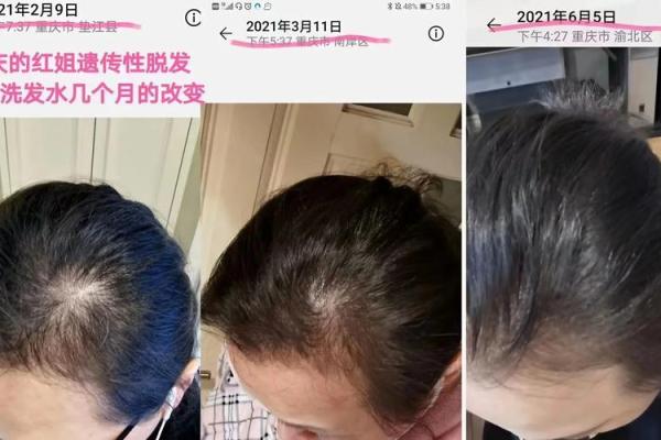探索头发细命理学：从发丝看人生运势与性格特征