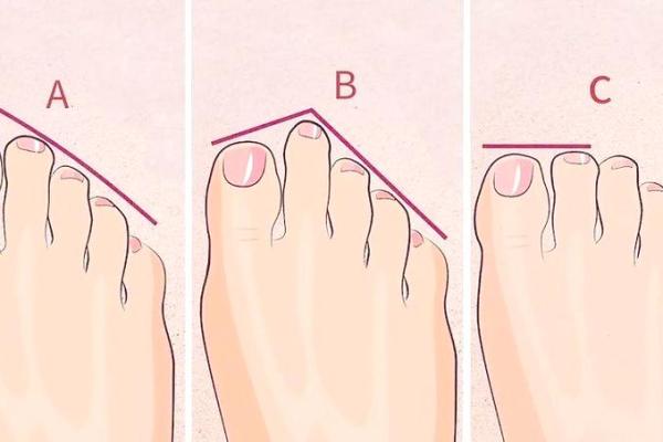 揭开富贵米字命的秘密:脚型与命运的奇妙关联 揭开富贵米字命的秘密:脚型与命运的奇妙关联