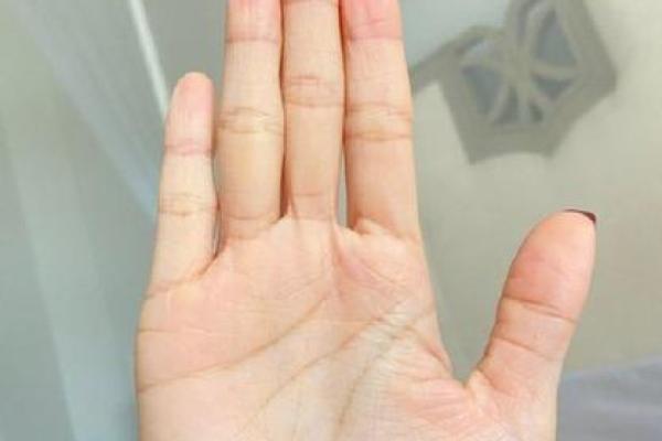 手指背面没有纹路，揭秘你的命运与性格密码！