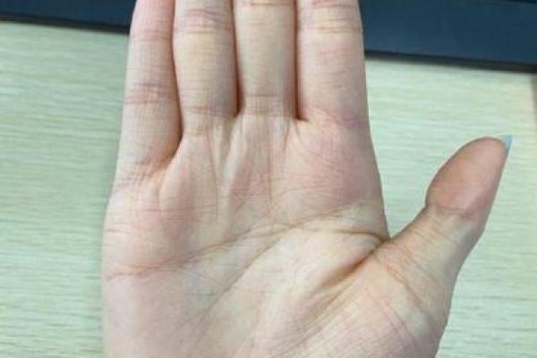 双手假断掌:命运与个性解析之旅 双手假断掌:命运与个性解析之旅