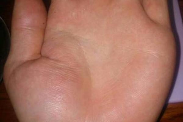 大拇指扁宽的命运：探寻独特的性格与生活之道