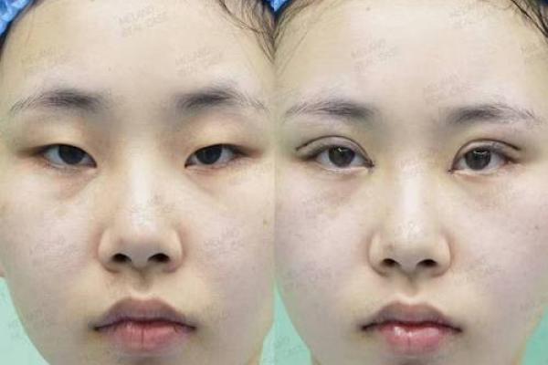 吊眼梢的女人:美丽与命运交织的故事 吊眼梢的女人:美丽与命运交织的故事